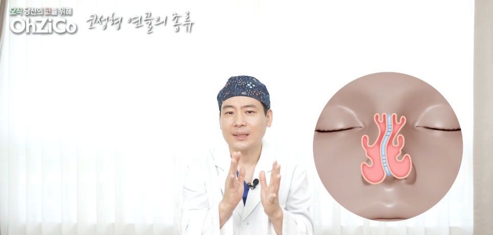 코성형 재료 연골의 종류와 특징! 관련 이미지 7