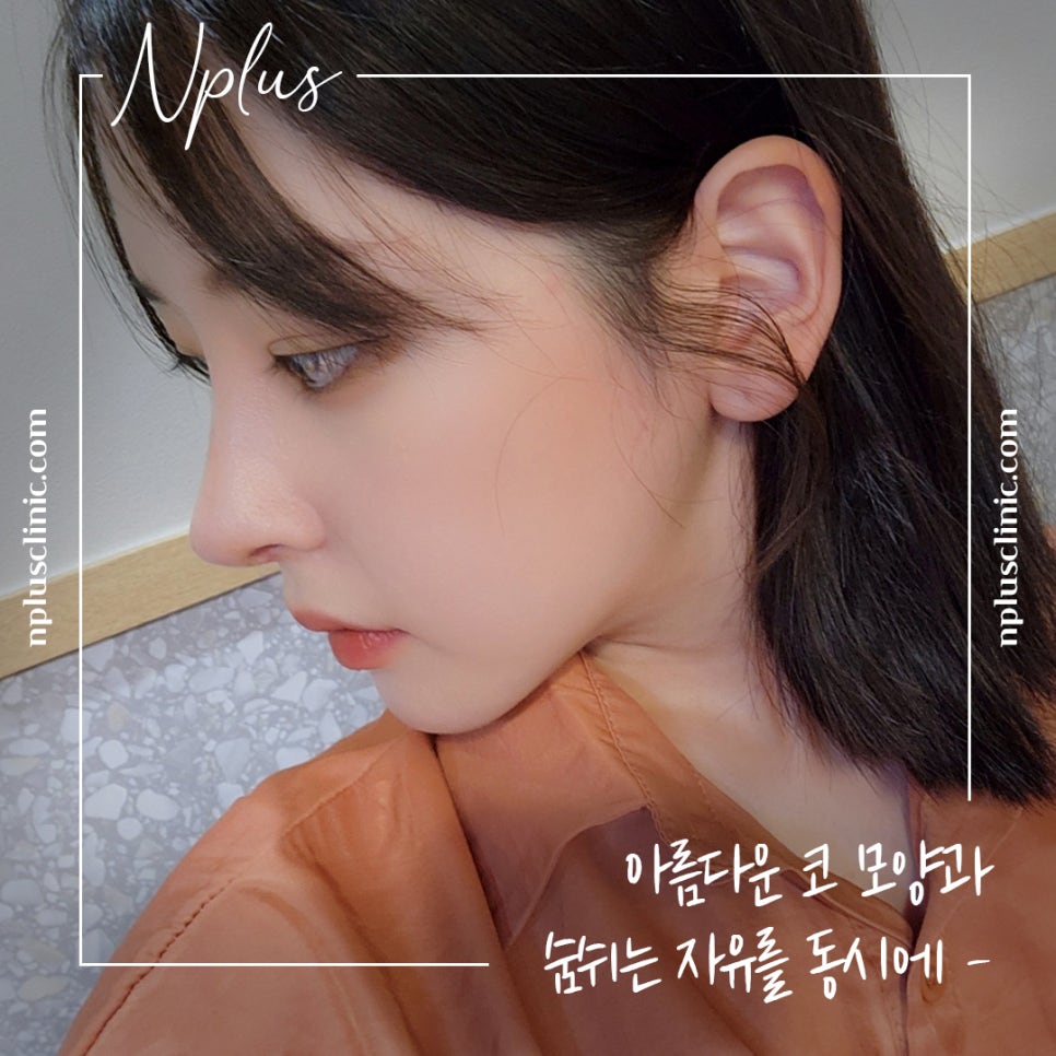 코끝수술후기 다양한 정보를 알아보고 관련 이미지 12