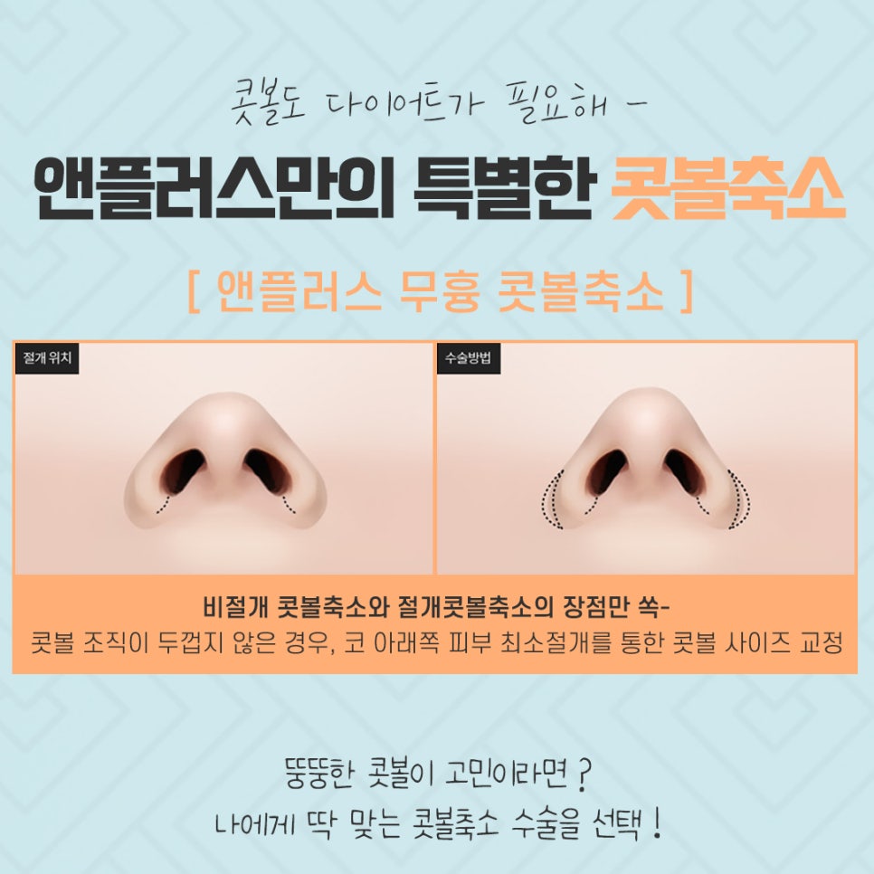 콧볼축소수술 흉터 없이 강남앤플러스에서! 관련 이미지 8