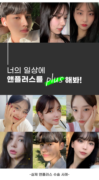 앤플러스에서 진행하는 기능코성형 EVENT 관련 이미지 13