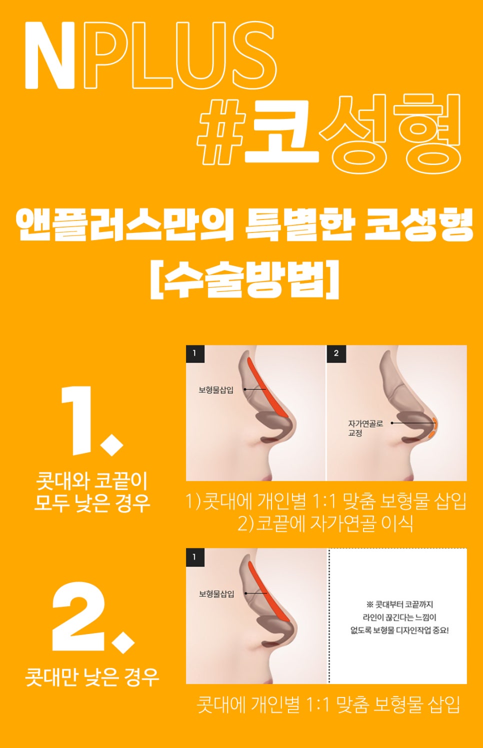 콧대수술_비염기능까지 고려해서 관련 이미지 3