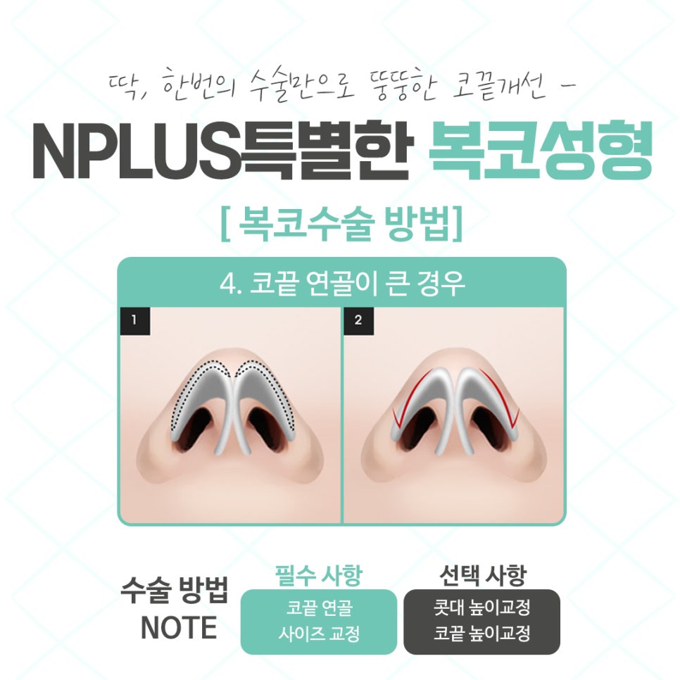 When Looking at Bulbous Nose Surgery Reviews image 11