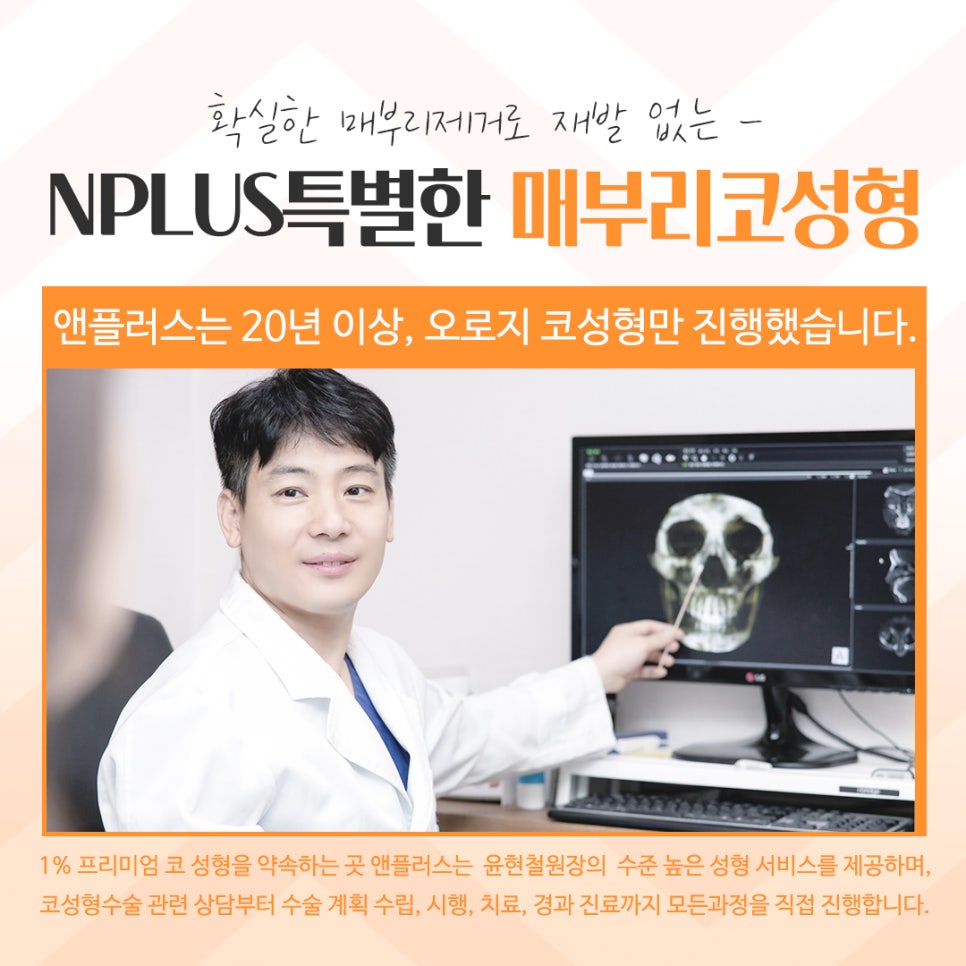 매부리코성형후기를 자세하게 알아보고 관련 이미지 14