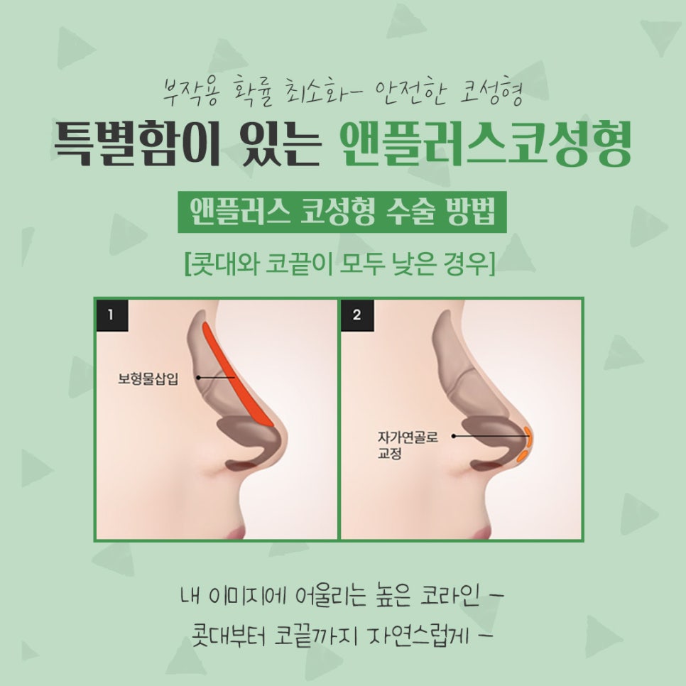코성형후기 자연스럽고 예쁘게 관련 이미지 8