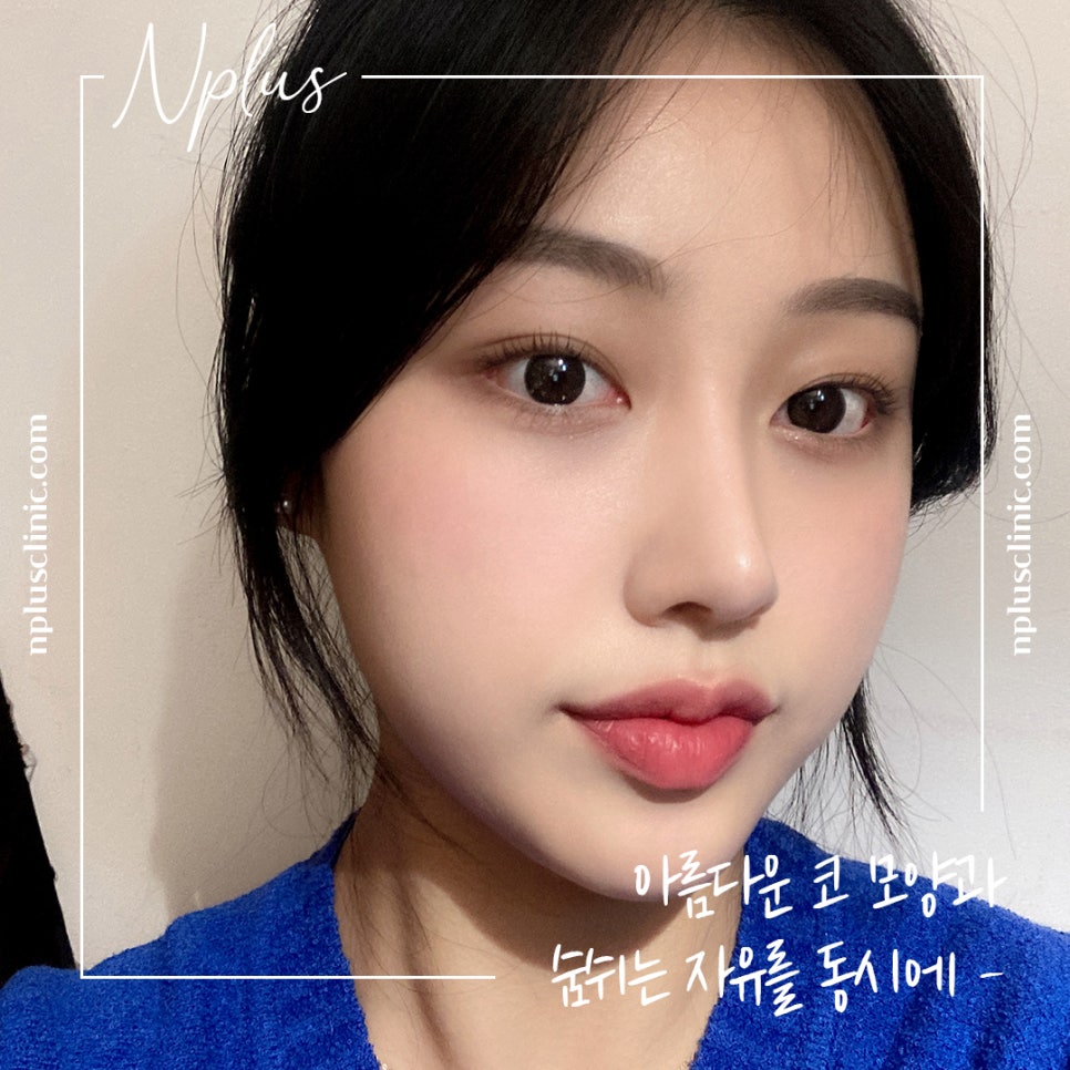콧볼축소수술 확실한 교정으로 관련 이미지 2