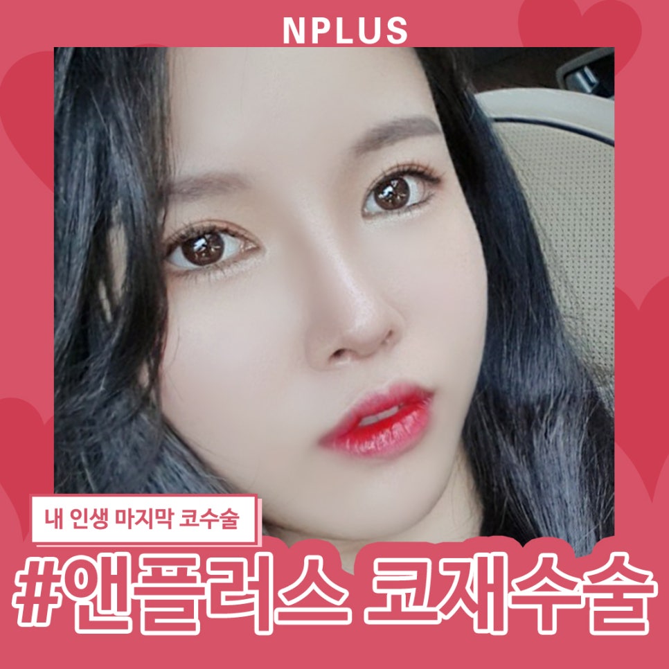 압구정성형외과_코재수술 본인 얼굴에 맞게 선택 관련 이미지 1