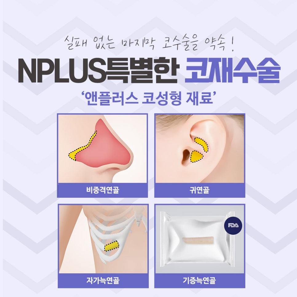 코재수술 후기까지 확실하게 관련 이미지 10