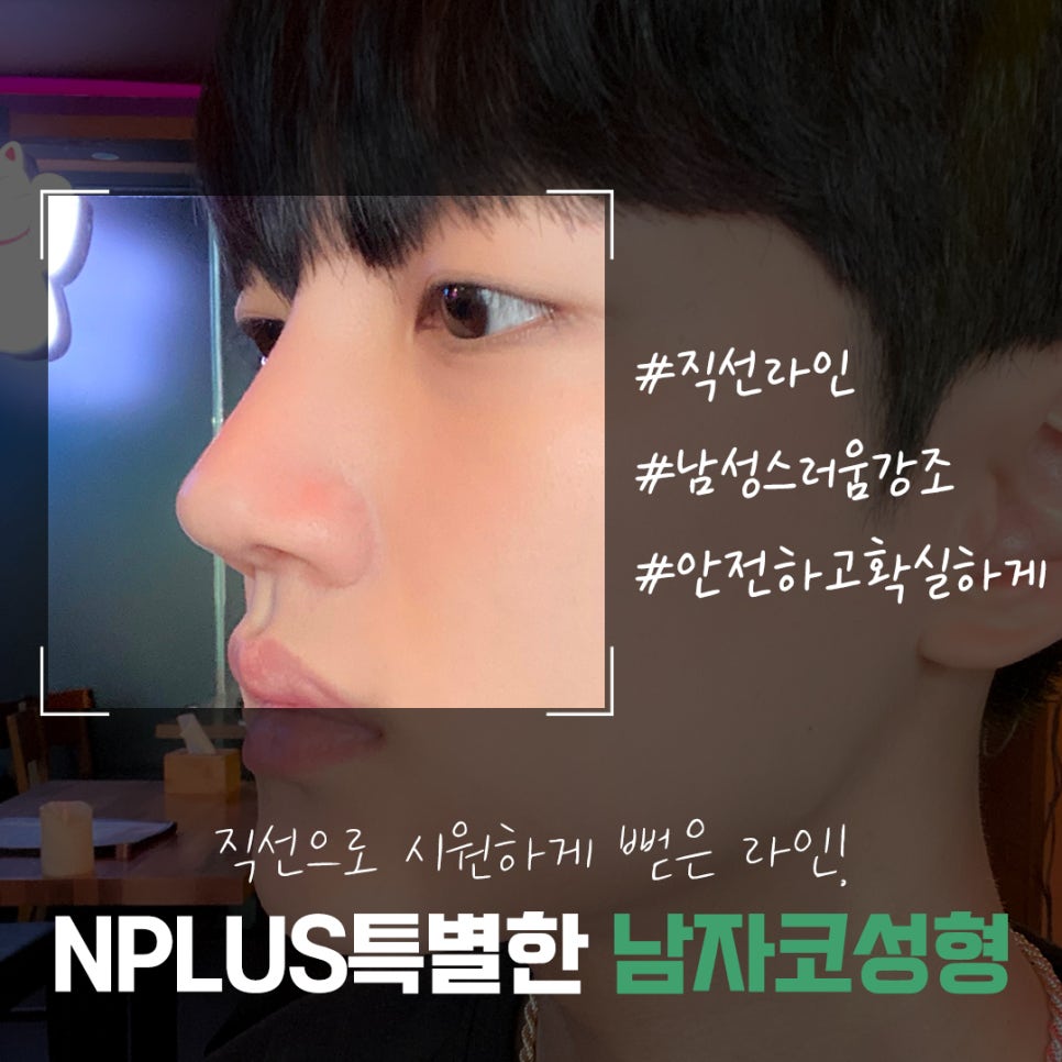 남자코수술후기 멋있고 자연스러운 라인으로 관련 이미지 3