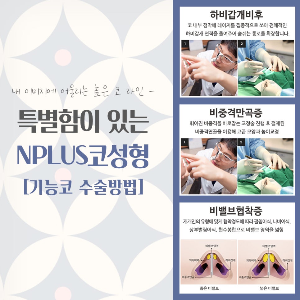 코수술후기 기능까지 확인하고 관련 이미지 11