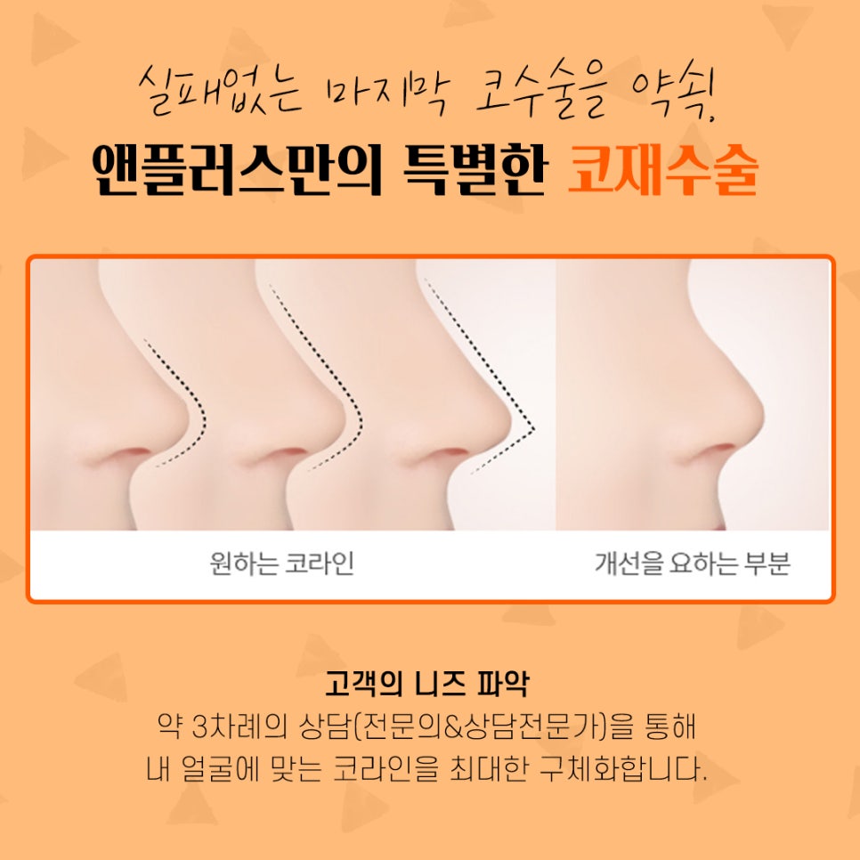 코재수술후기 자연스럽고 예쁘게 관련 이미지 6