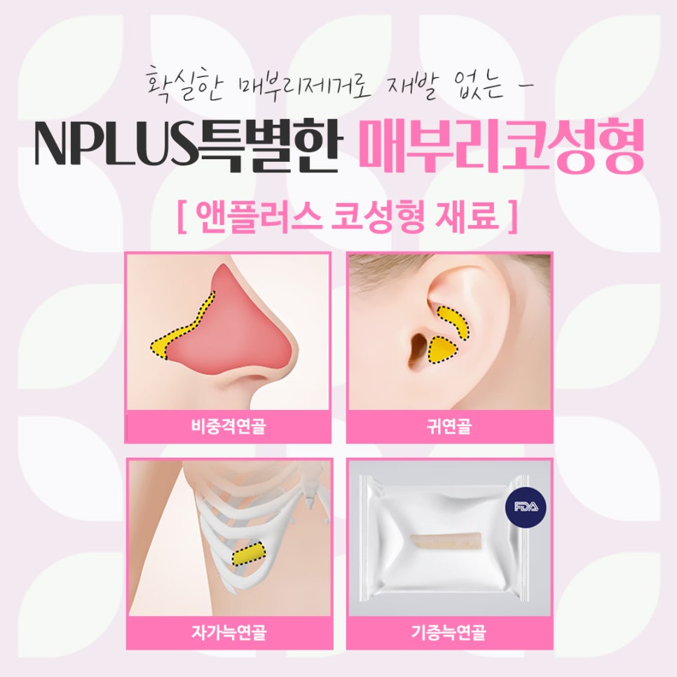 매부리코성형후기를 통해 이미지 개선 관련 이미지 12