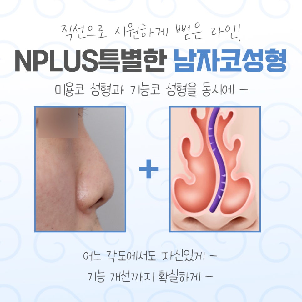 남자코성형전후 비교해 보고 관련 이미지 4