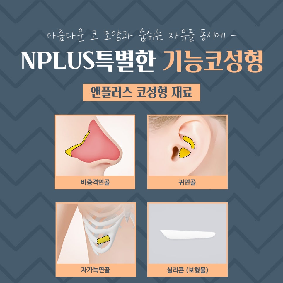 기능코성형후기 정확한 원인 분석으로 관련 이미지 12