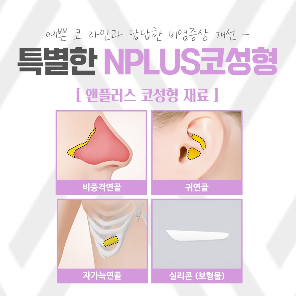 낮은코성형에 대한 정보를 찾아본다면 관련 이미지 8