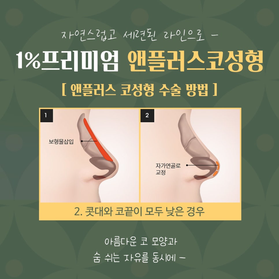 자가늑연골코수술 기능까지 생각해서 관련 이미지 9