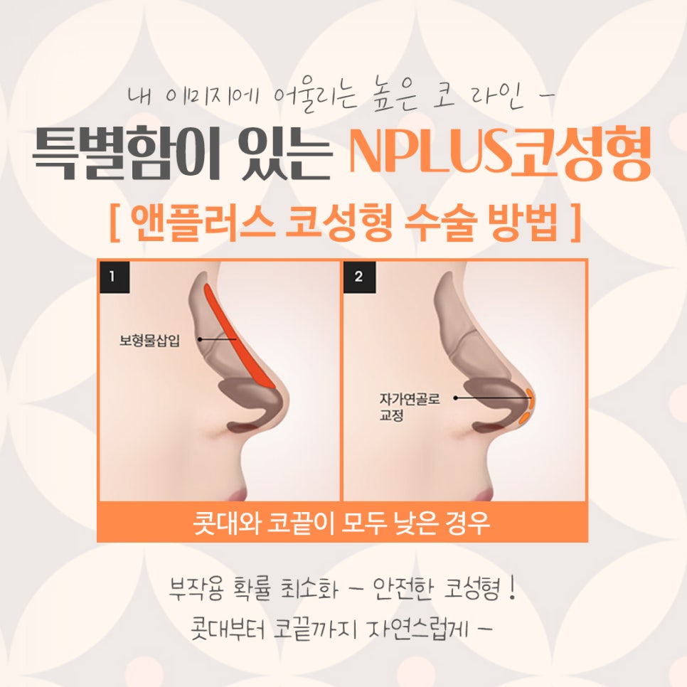 코성형잘하는병원 다양하게 알아보고 관련 이미지 7