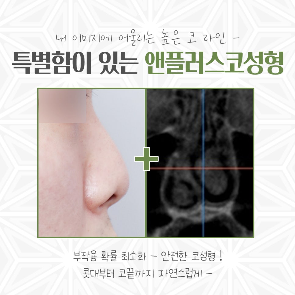 Make Sure to Review Rhinoplasty Costs Carefully Before Deciding image 4