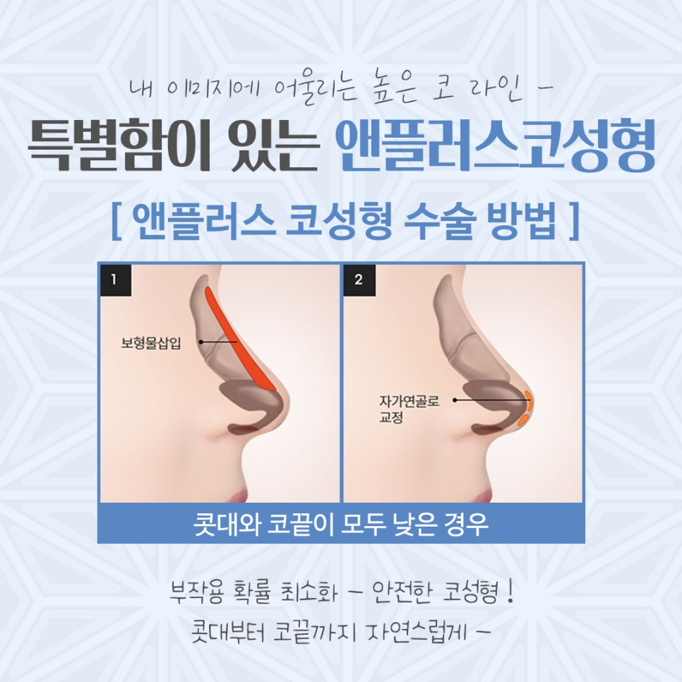 Carefully Reviewing Rhinoplasty Costs image 8