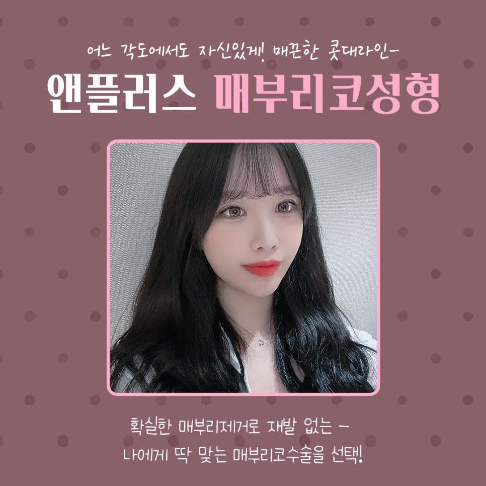 코끝처짐 개선한 매부리코성형후기 관련 이미지 2