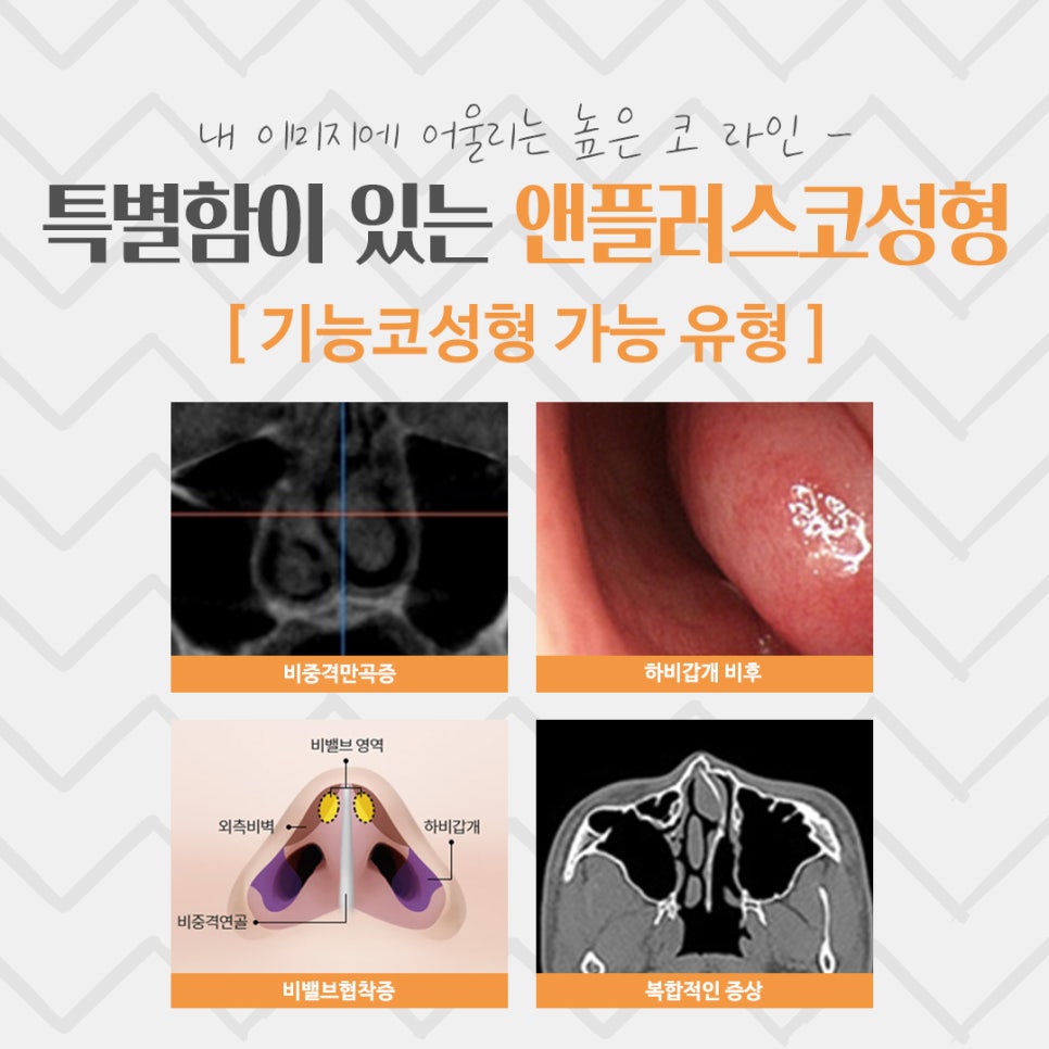 코성형후기 예쁘고 자연스러운 라인으로 관련 이미지 5