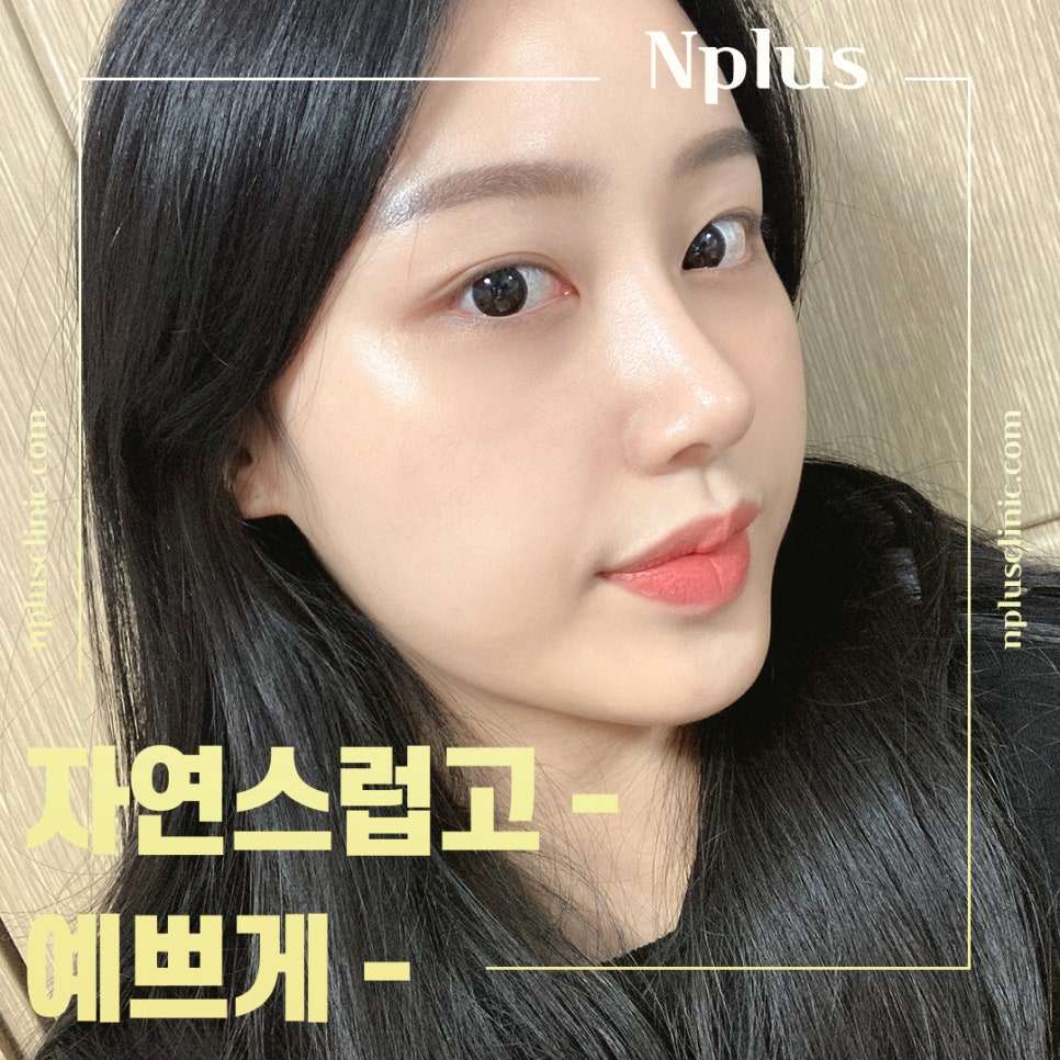 Creating a More Three-Dimensional Look with Low Nose Surgery image 5