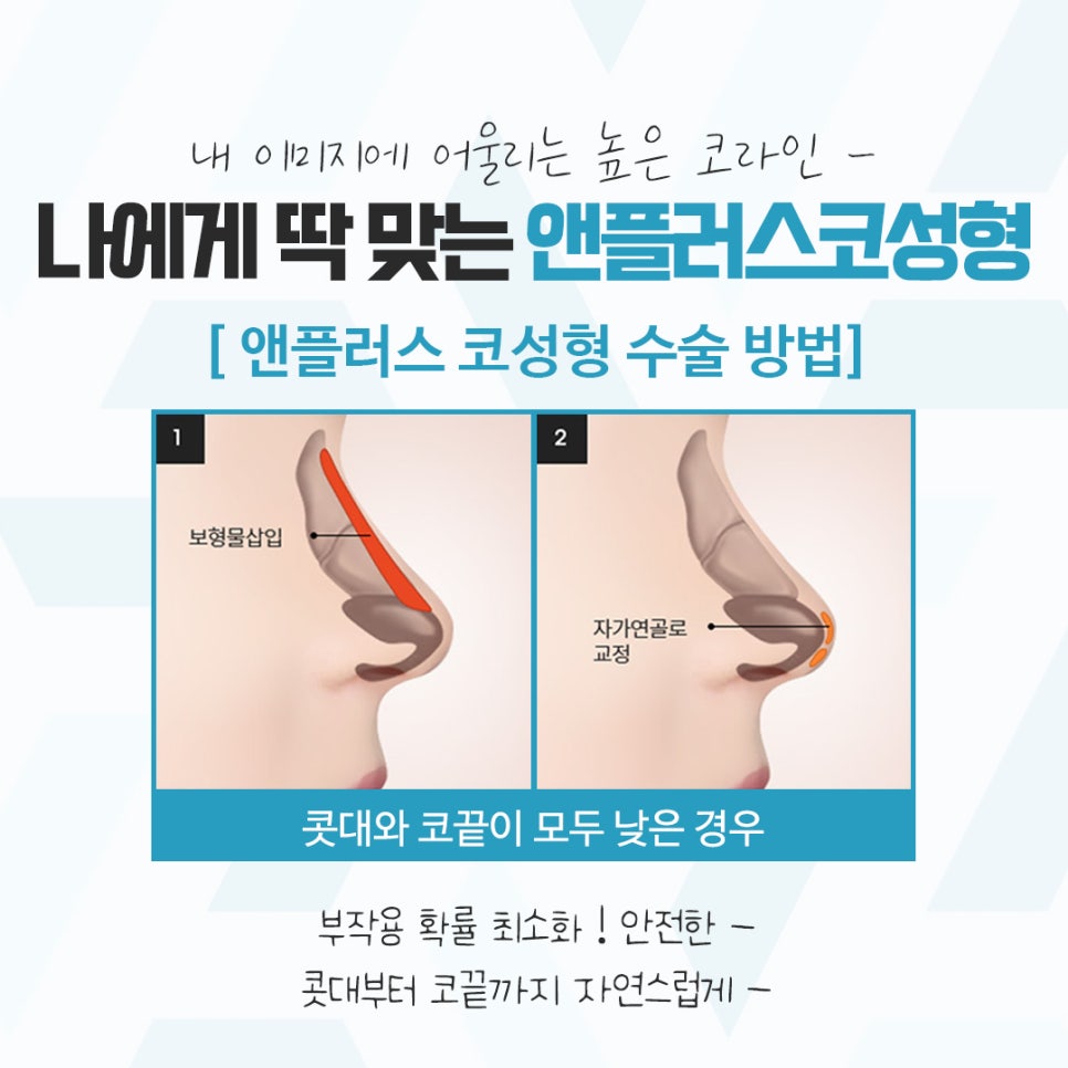 코성형후기 다양한 이미지를 고려하여 관련 이미지 8