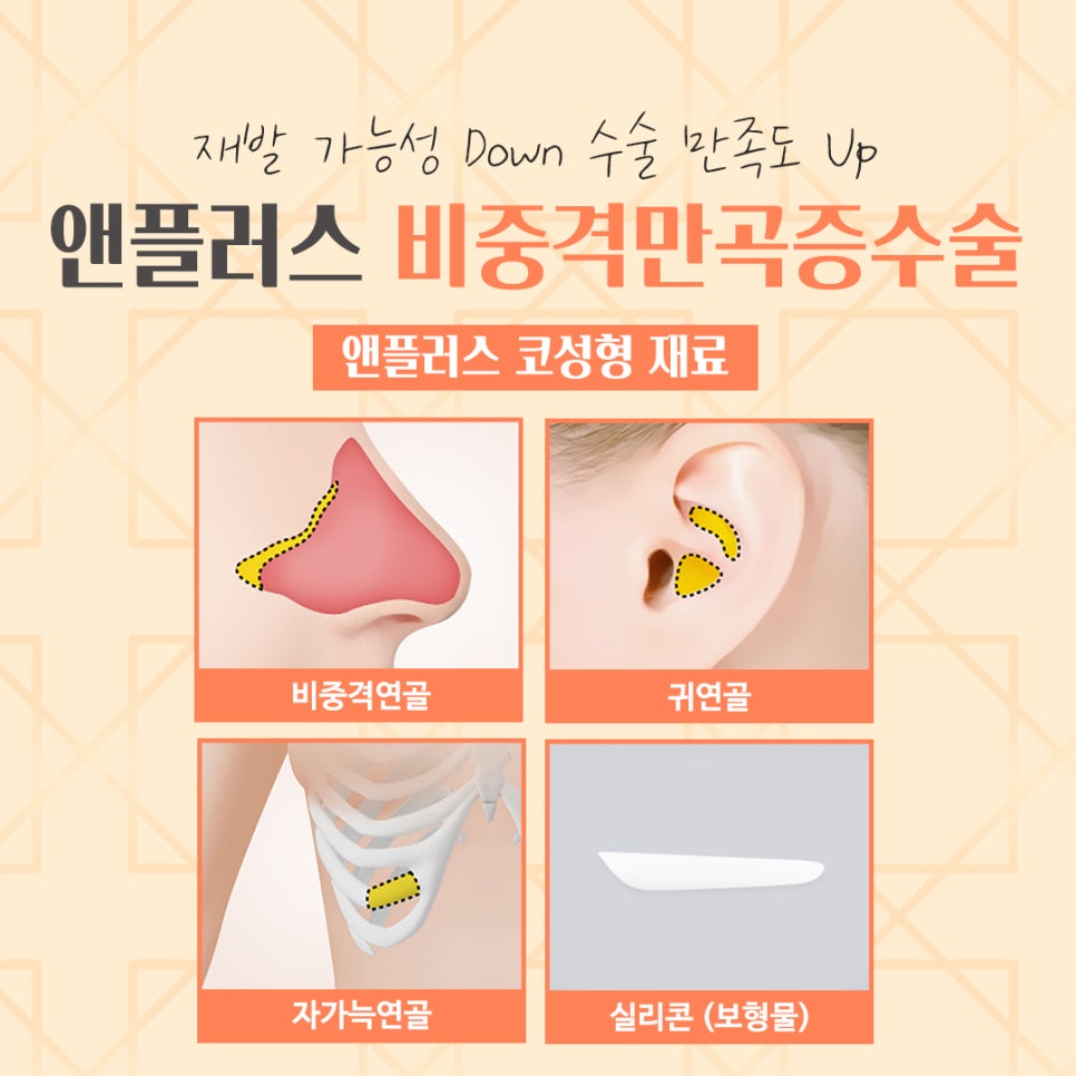 비중격만곡증수술후기 코 내부를 정확하게 파악해야 관련 이미지 12