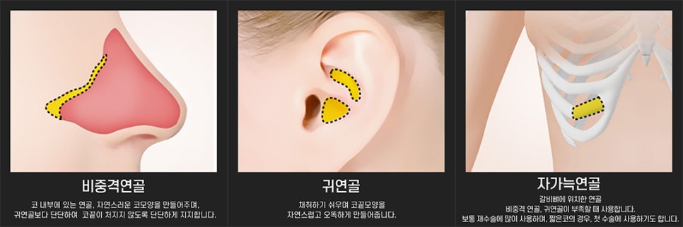 Let’s Find Confidence with a Small, Low Nose and a Beautiful Nose Shape! image 8