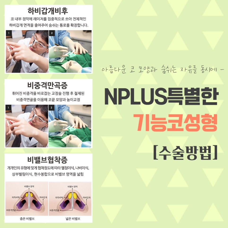 코성형보험에 대해 정확하게 알아보고 관련 이미지 11