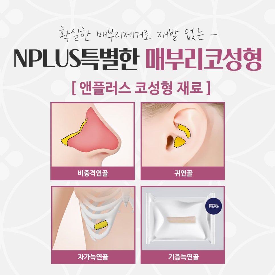 매부리코수술후기 예쁜코라인으로 관련 이미지 13