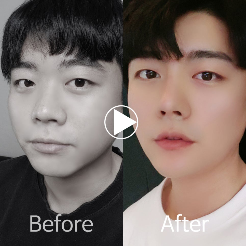 🎀앤플러스 코성형 모델모집🎀 관련 이미지 7