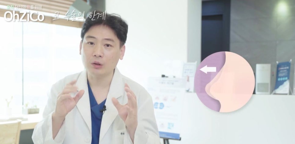 코성형 하면 예쁜코와 효과 없는 코! 관련 이미지 3