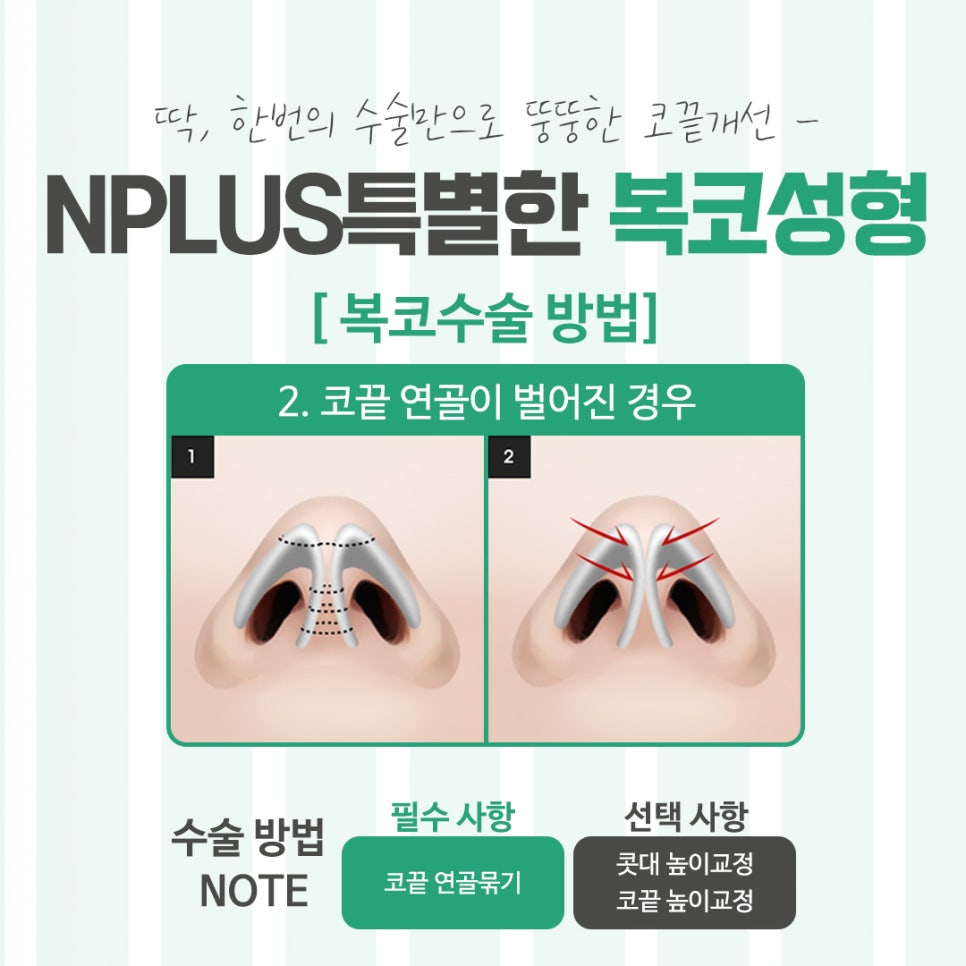 Looking Into Bulbous Nose Surgery Reviews to Improve Your Appearance image 8