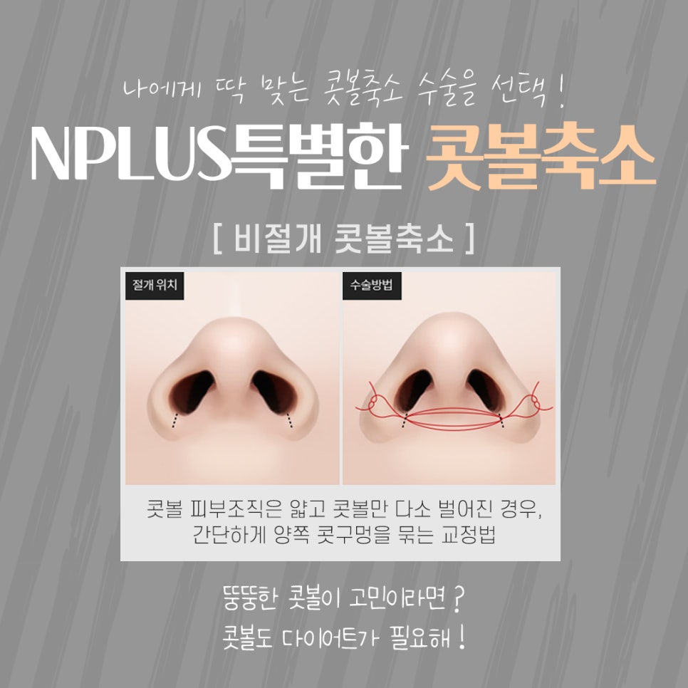 콧볼축소수술후기 내게 어울리는 라인으로 관련 이미지 9