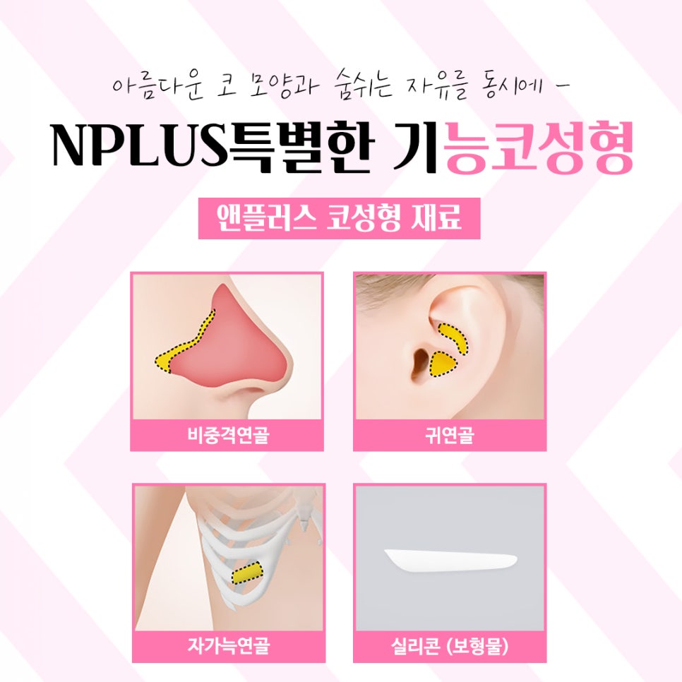 앤플러스 기능코수술후기 선택의 중요성 관련 이미지 10