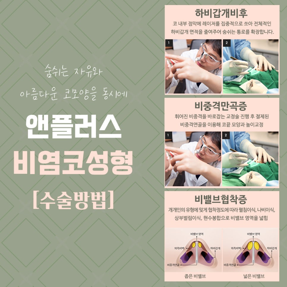 비염코성형후기 라인까지 고려하여 관련 이미지 9