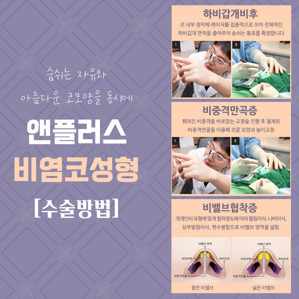 Looking Into Rhinitis Rhinoplasty Reviews and Benefits image 8