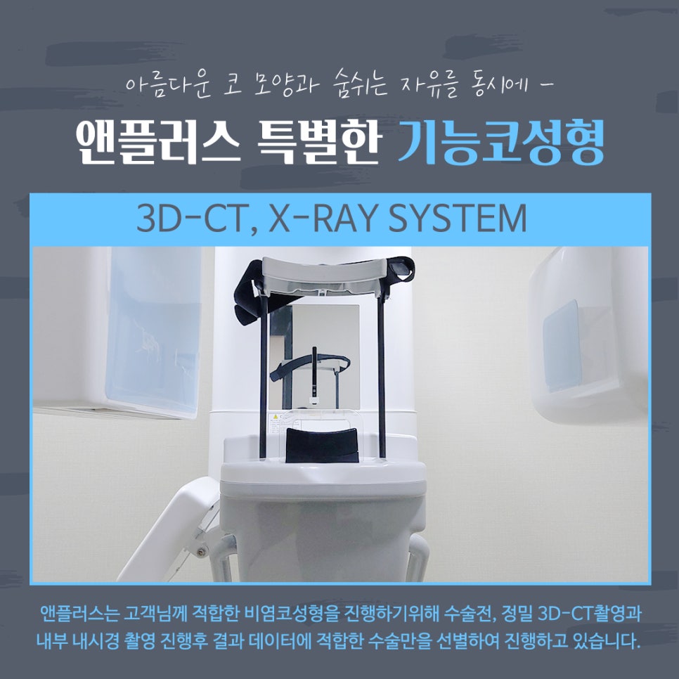 Rhinoplasty Review That Also Improved Function image 6