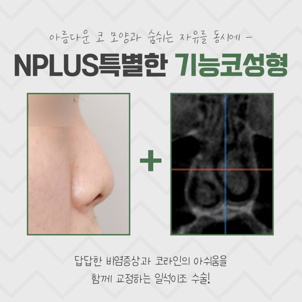 한쪽코막힘 개선으로 시원한 일상 관련 이미지 3