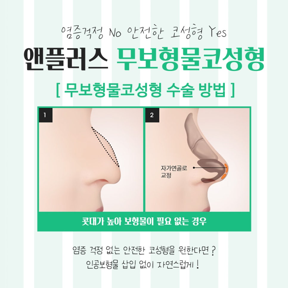 Take a Detailed Look at Reviews of Non-Implant Nose Surgery image 8