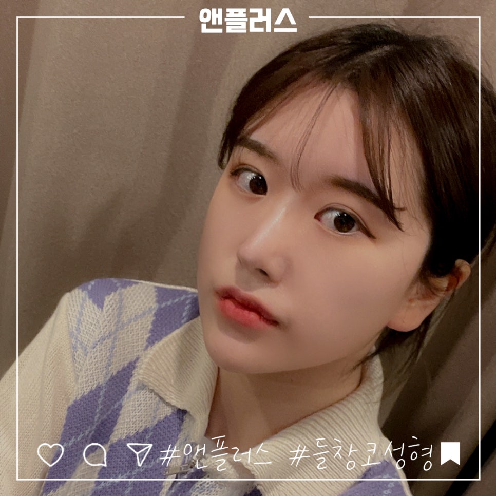 짧은코수술 후기까지 확실하게 관련 이미지 12