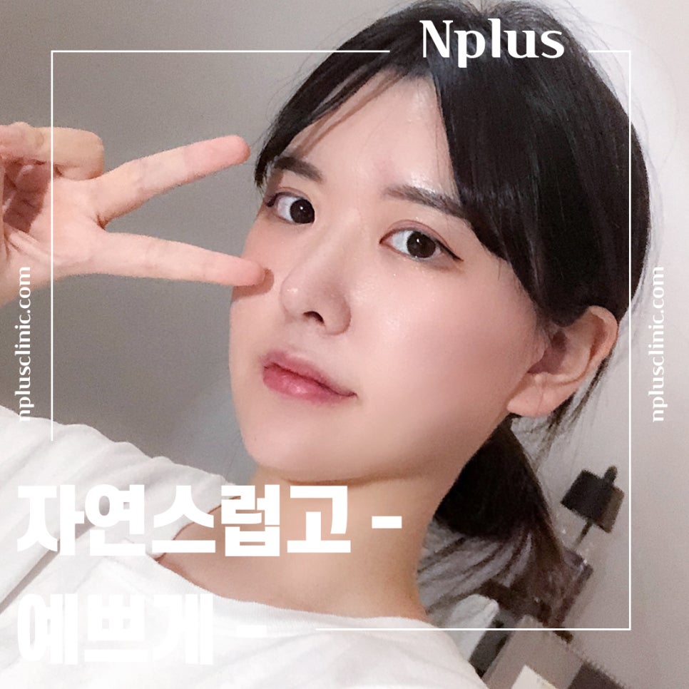 기능코성형을 통한 한쪽 코막힘 개선 관련 이미지 1