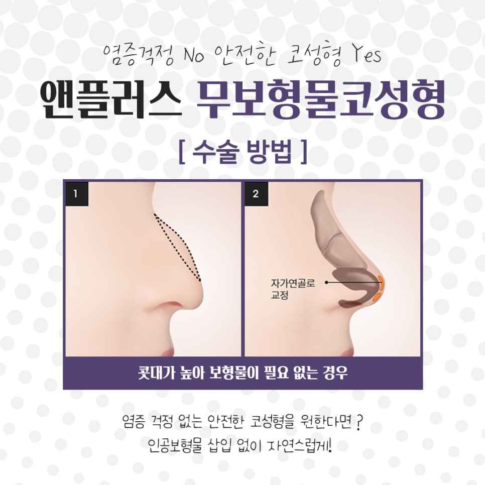 Accurately Check Non-Implant Rhinoplasty image 8