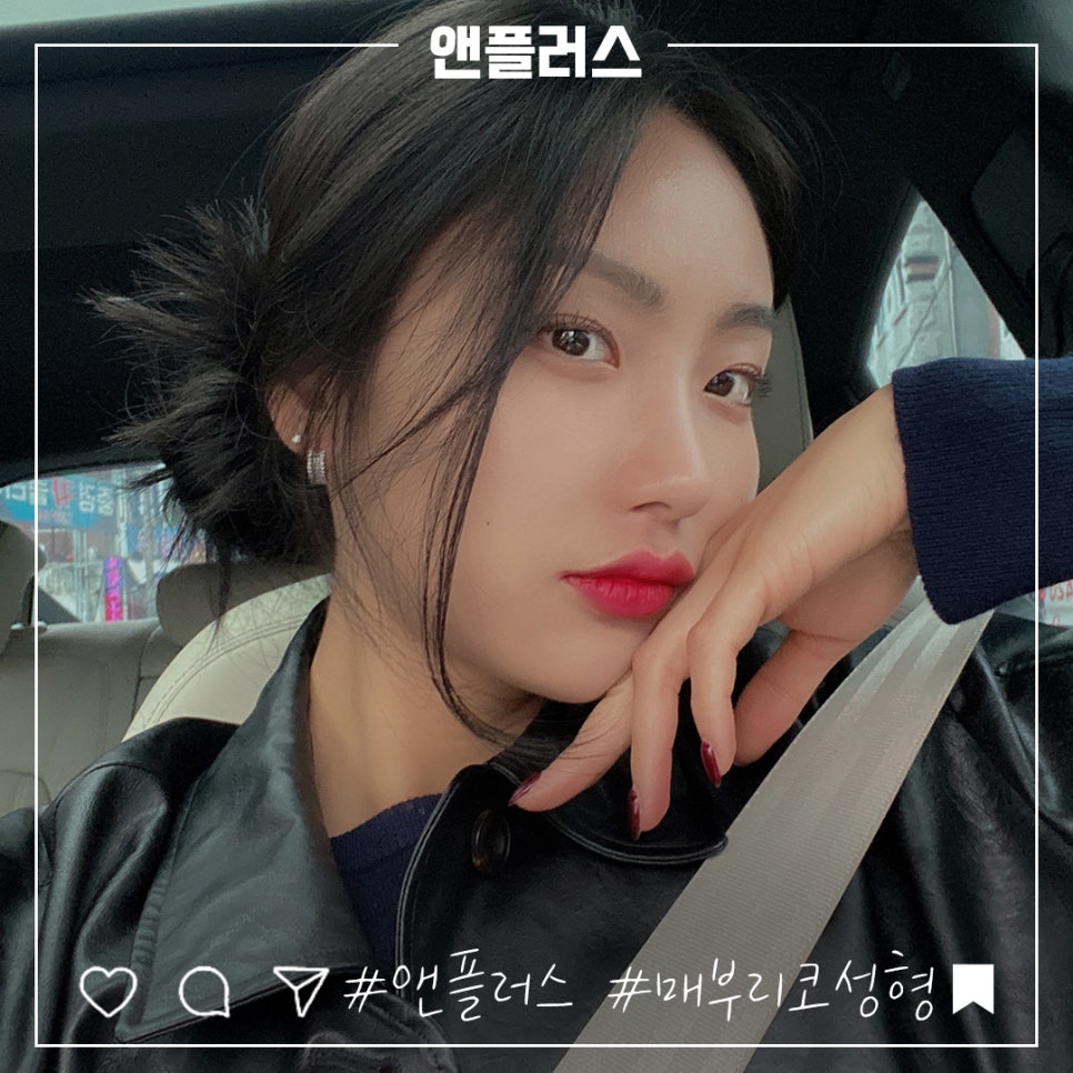 매부리코성형후기 코끝처짐을 개선하여 관련 이미지 1