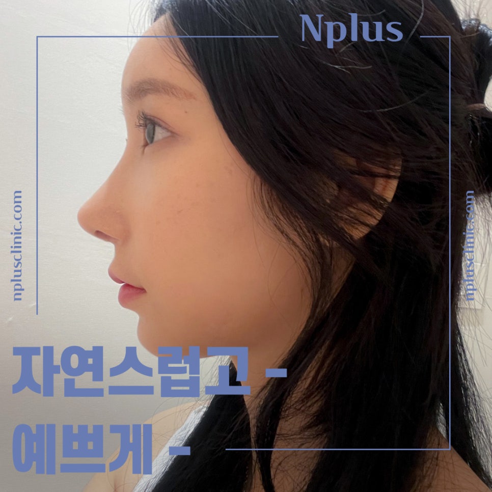 Looking Closely at the Differences Before and After Nose Surgery image 1