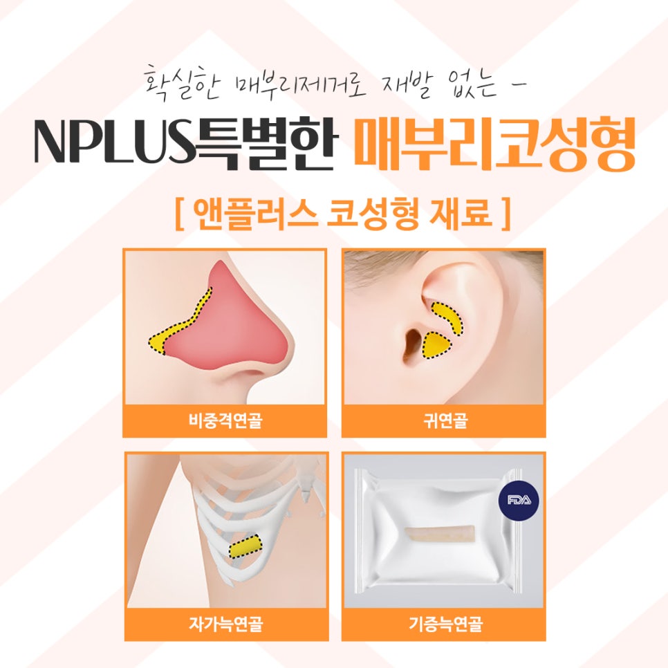 Hump Nose Surgery Review with a Clear Diagnosis image 12