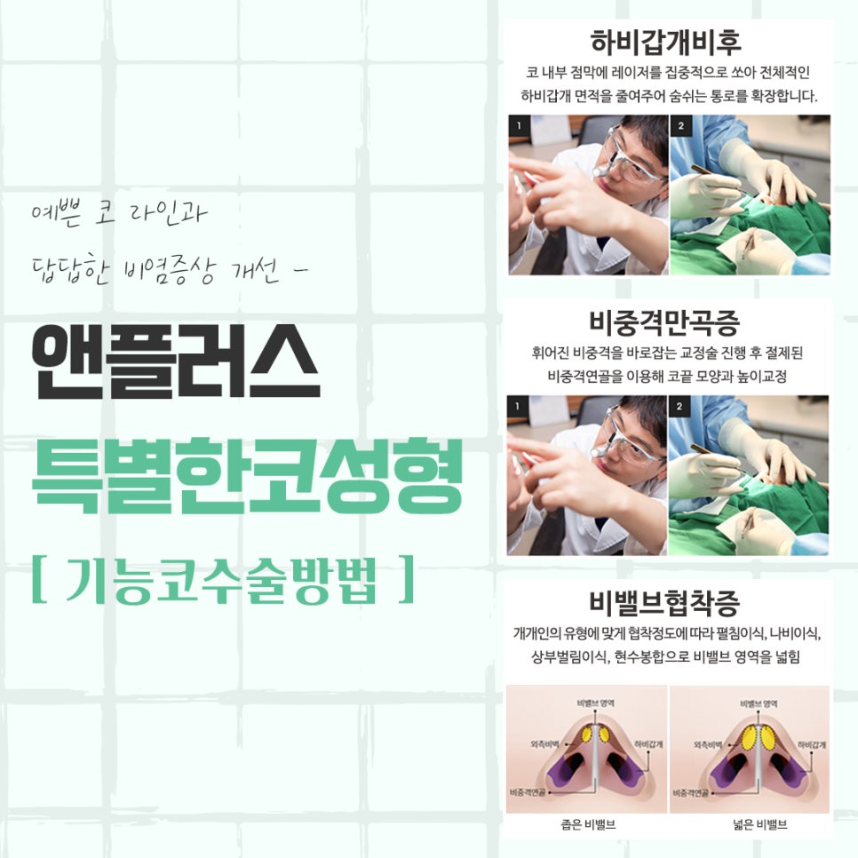 Learn in Detail About Nose Surgery in Gangnam image 7