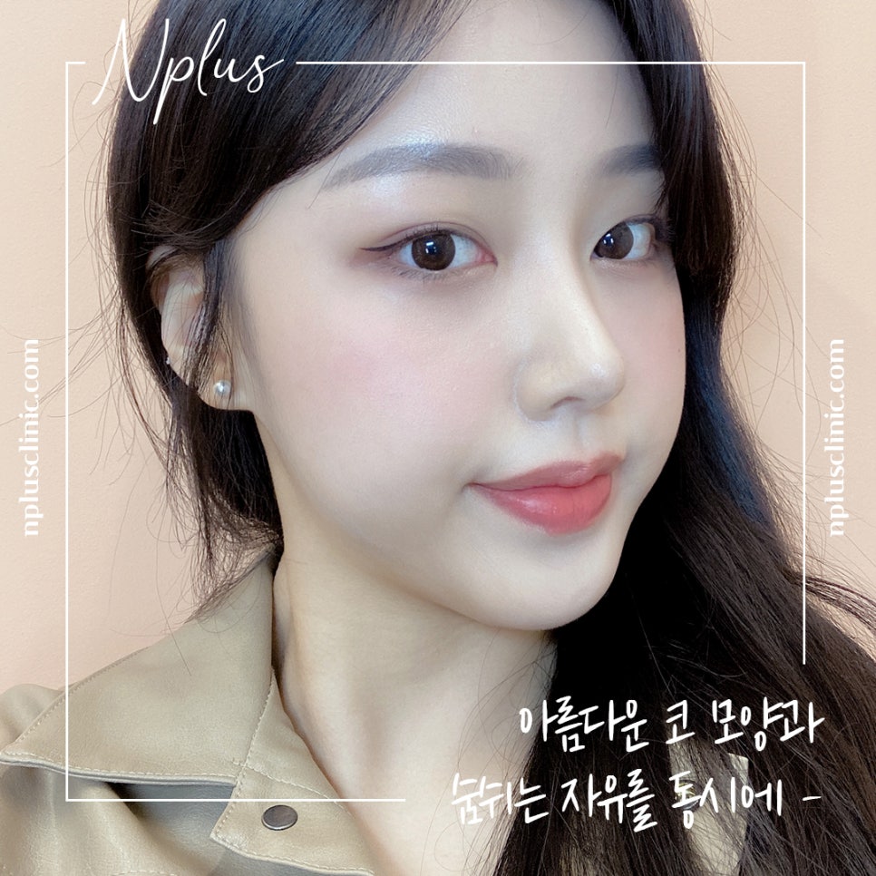 콧볼축소수술후기 내게 어울리는 라인으로 관련 이미지 11
