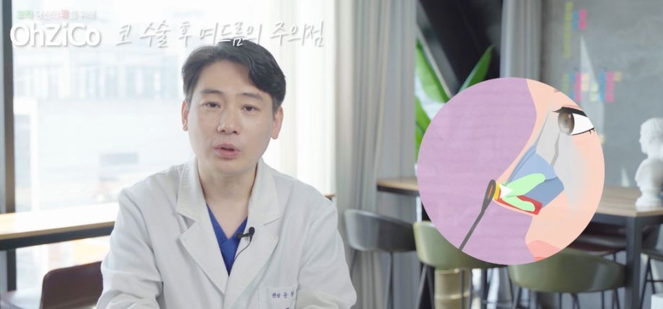 코수술후 코여드름 원인과 해결 방법 관련 이미지 25