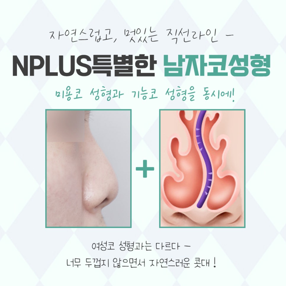 Check Male Rhinoplasty Before and After and Improve Your Image image 12